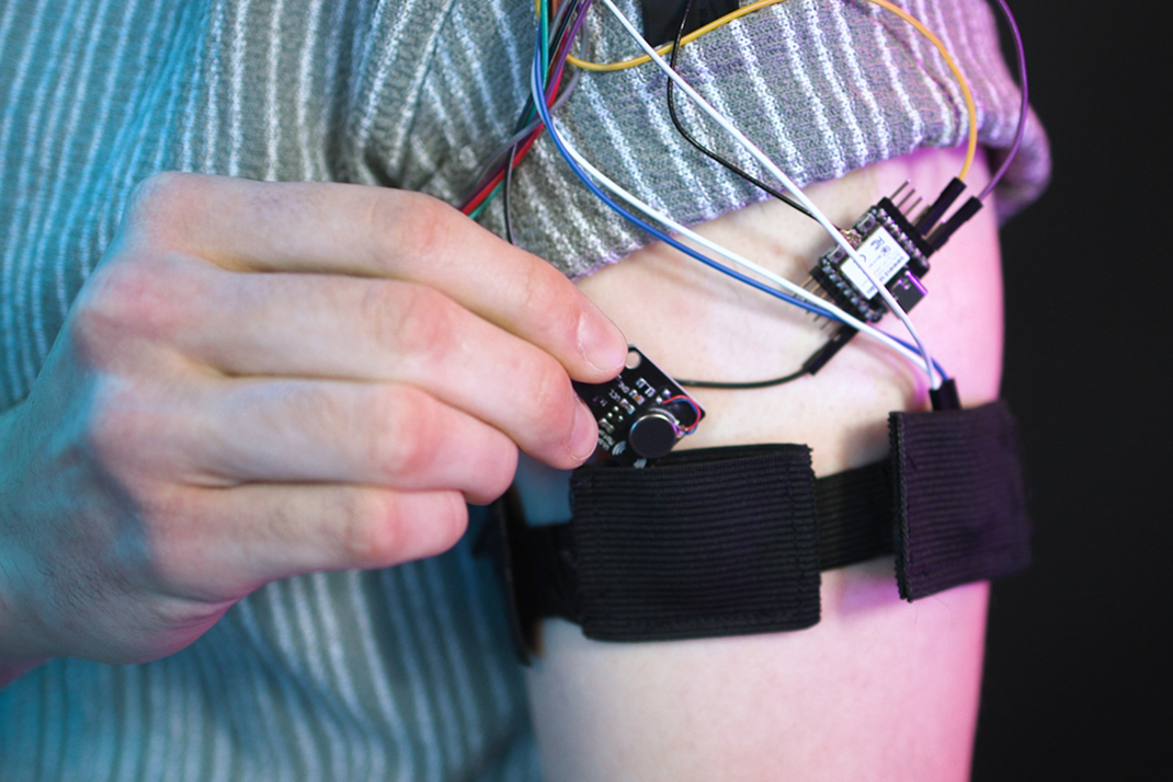 A close-up of sensors attached to an arm as wearables.